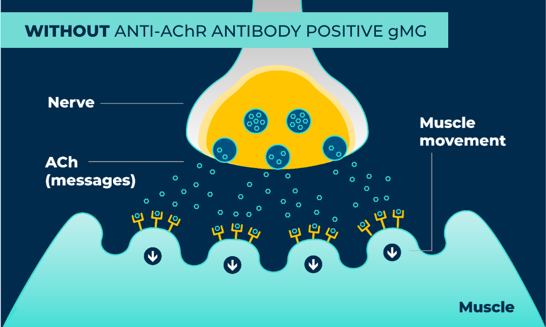 Without gMG, muscles get messages from nerves that tell the muscles to move.